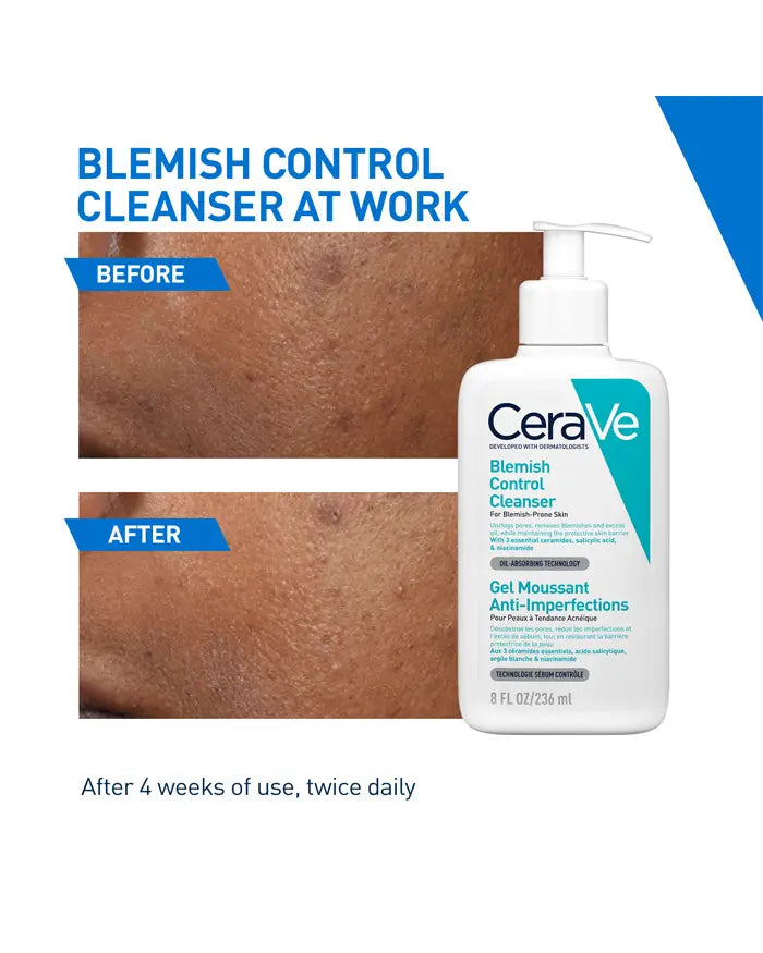 CeraVe Blemish Control Cleanser with 2% Salicylic Acid & Ceramides