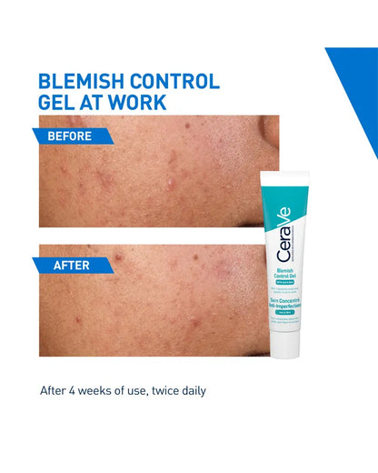 CeraVe Blemish Control Gel with Salicylic Acid & Ceramides (40ml)