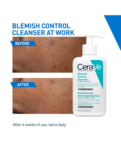 CeraVe Blemish Control Cleanser with 2% Salicylic Acid & Ceramides