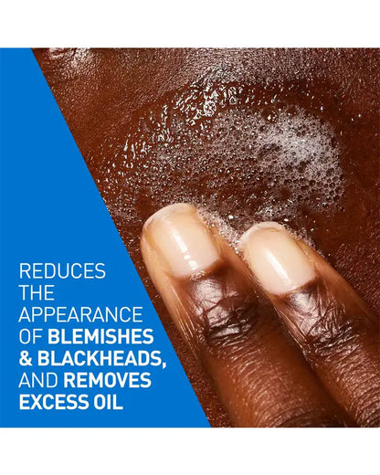 CeraVe Blemish Control Cleanser with 2% Salicylic Acid & Ceramides